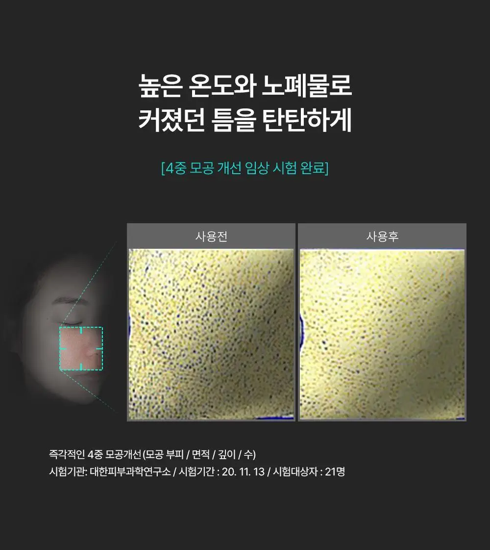 [쿨링/저자극/피지] 런드리유 클린 페이스 가글 젤 투 폼 클렌저 스트롱 160g+30g 기획 상세페이지 8